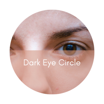 rejuran healer dark eye circles under eye polynucleotide skin booster