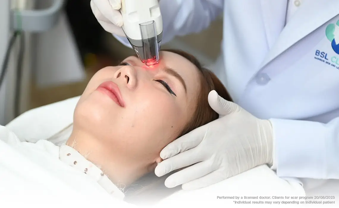 fraxel laser bangkok morpheus8 combination treatment at bsl clinic fraxel dual laser for skin resurfacing and pigmentation morpheus8 rf microneedling for deep skin tightening fraxel vs morpheus8 results before and after skin rejuvenation treatment