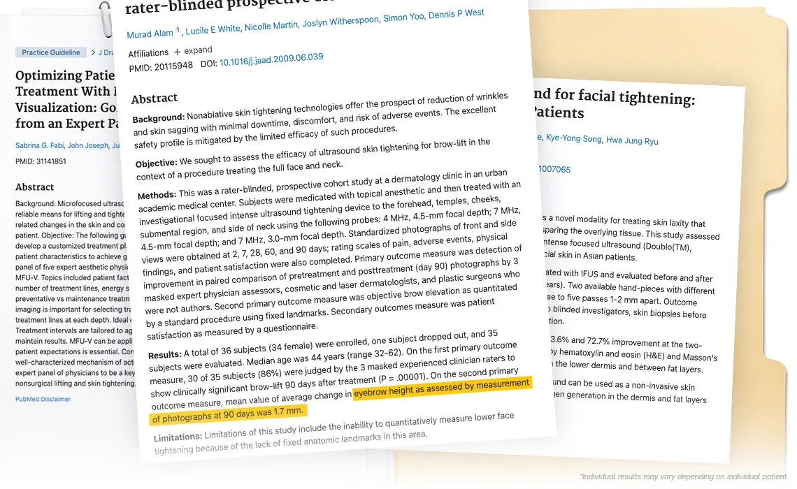 What Science Says About Ultherapy Prime Program