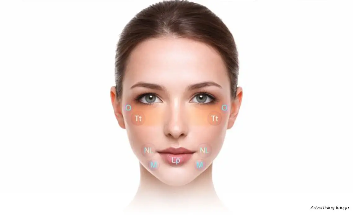 md codes refinement under eye filler tear trough periorbital smoothing lip filler perioral lines corner lift nasolabial folds hyaluronic acid filler natural results bsl clinic bangkok
