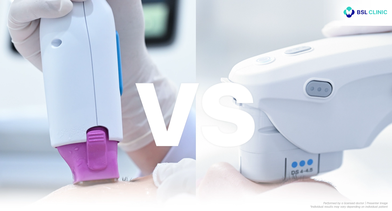 热玛吉 vs 超声刀