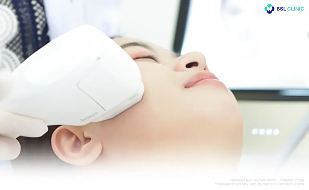 Collagen stimulation with subtle volume support 1024x629