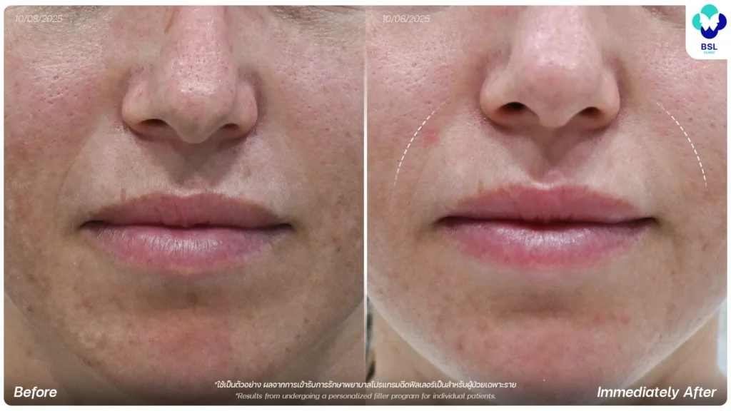Keira &mdash; Looking More Refreshed, Not Different