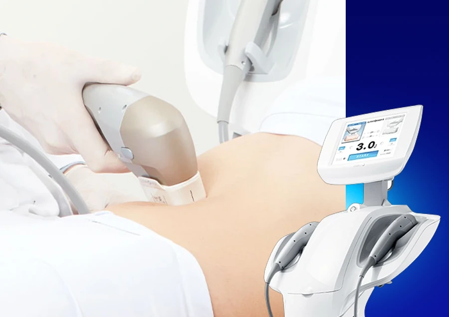 Ultraformer-III-related-tech-botdy-slimming