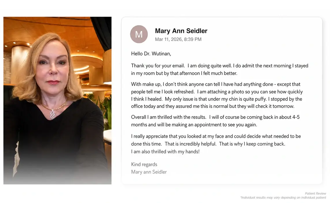 Mary discussing her natural-looking non surgical face lift results at BSL Clinic